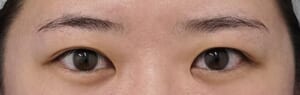 ⑧手術前