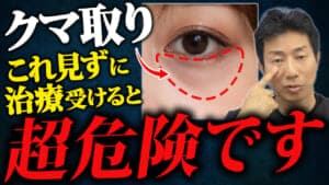 目の下のクマができる原因とタイプ別のクマ取り治療法を解説