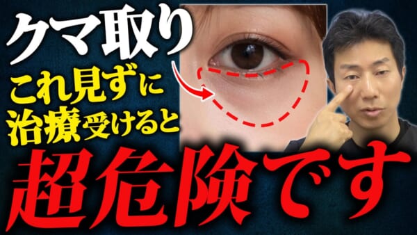 9割が知らない「目の下のクマ」の本当の原因　