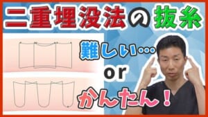 埋没法抜糸、難しい場合、簡単な場合 サムネイル