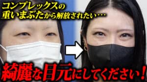 眉下切開ビフォアアフター動画