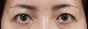 40代 3ヶ月後