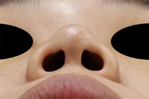 7術前下から