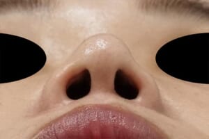 7術後下から
