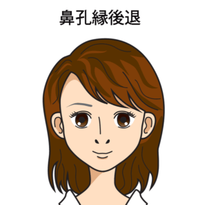 鼻孔縁後退文字入り